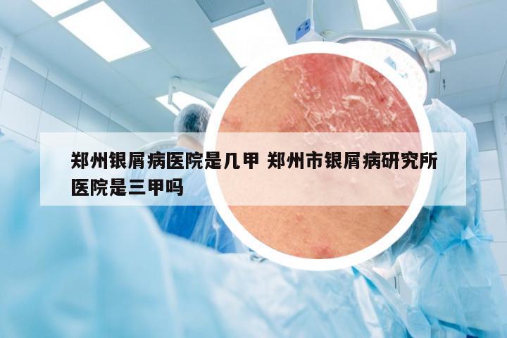 郑州银屑病医院是几甲 郑州市银屑病研究所医院是三甲吗