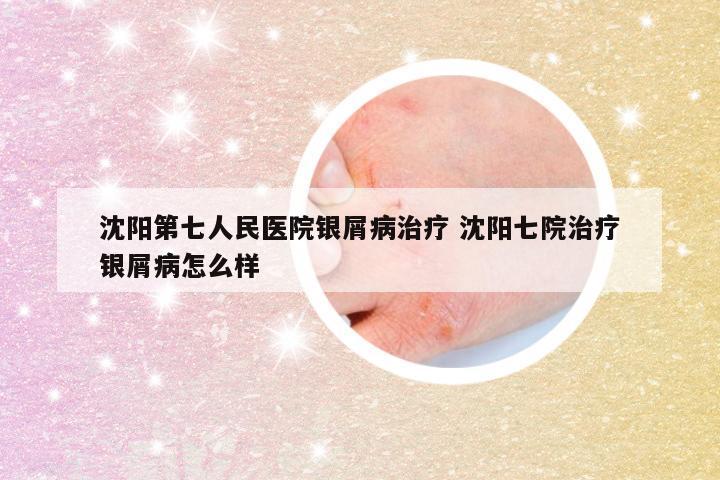 沈阳第七人民医院银屑病治疗 沈阳七院治疗银屑病怎么样