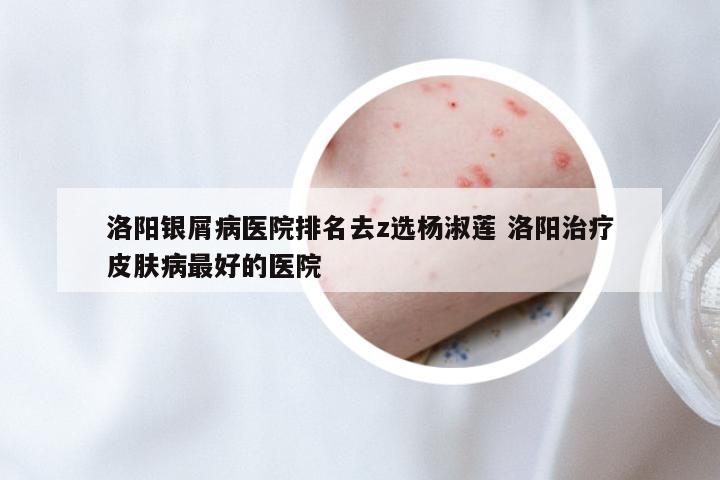 洛阳银屑病医院排名去z选杨淑莲 洛阳治疗皮肤病最好的医院