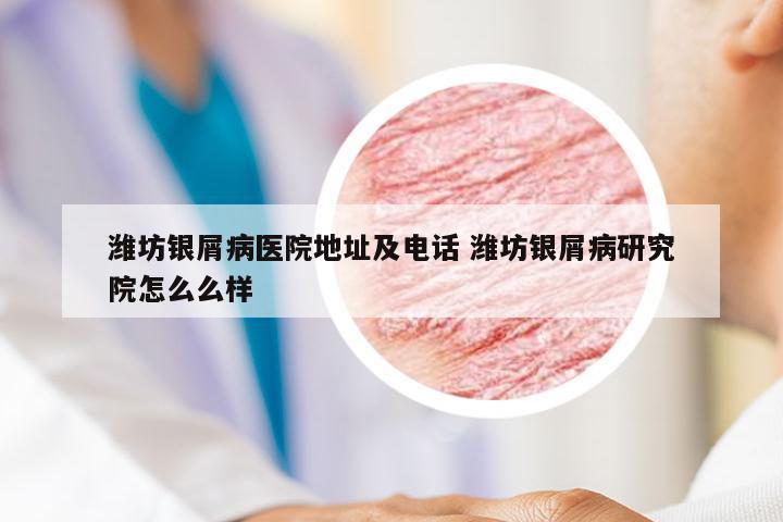 潍坊银屑病医院地址及电话 潍坊银屑病研究院怎么么样