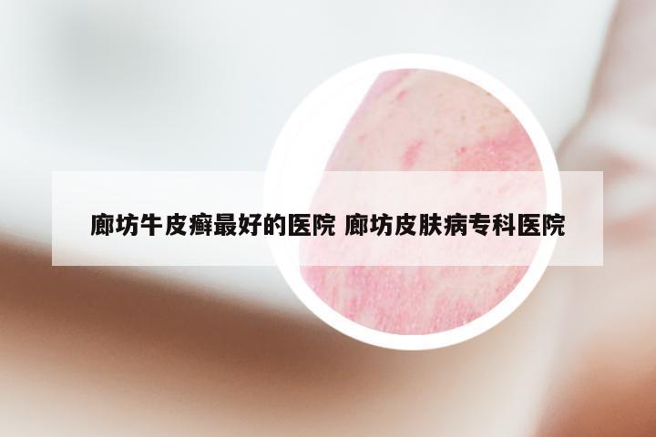 廊坊牛皮癣最好的医院 廊坊皮肤病专科医院