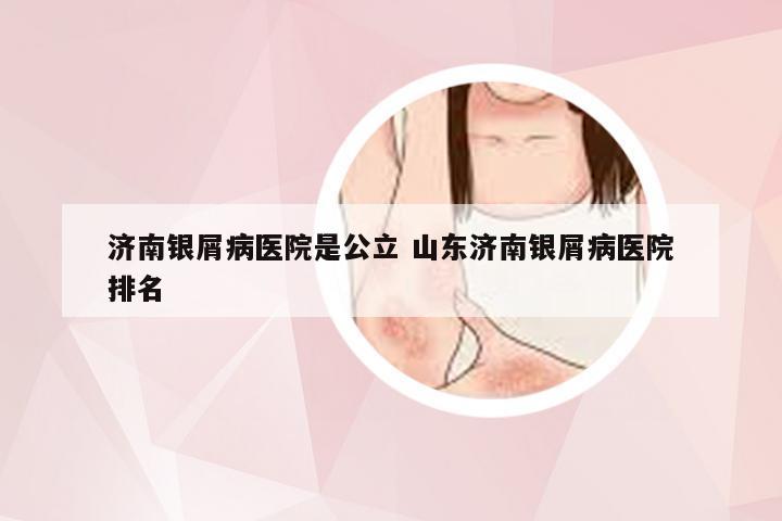 济南银屑病医院是公立 山东济南银屑病医院排名