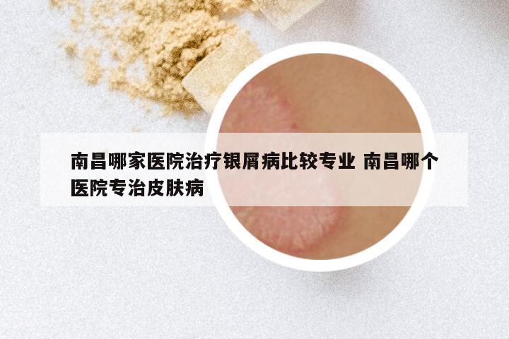 南昌哪家医院治疗银屑病比较专业 南昌哪个医院专治皮肤病