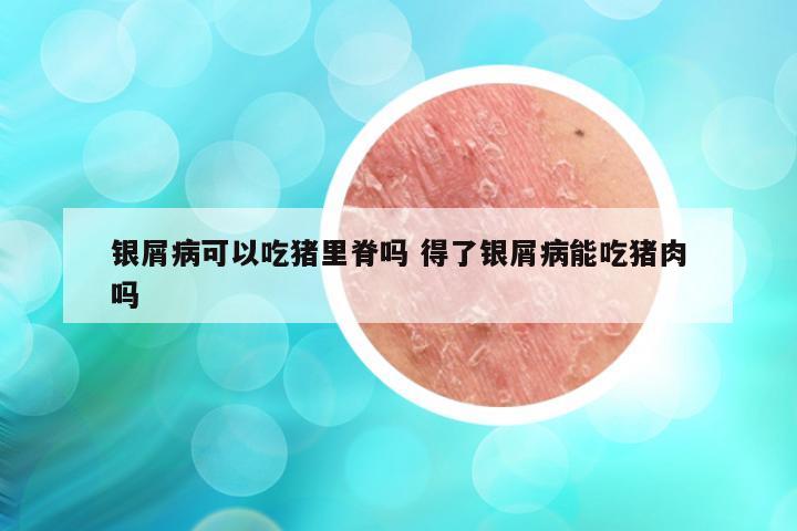 银屑病可以吃猪里脊吗 得了银屑病能吃猪肉吗