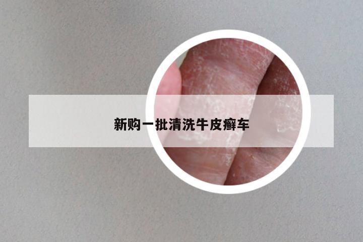 新购一批清洗牛皮癣车