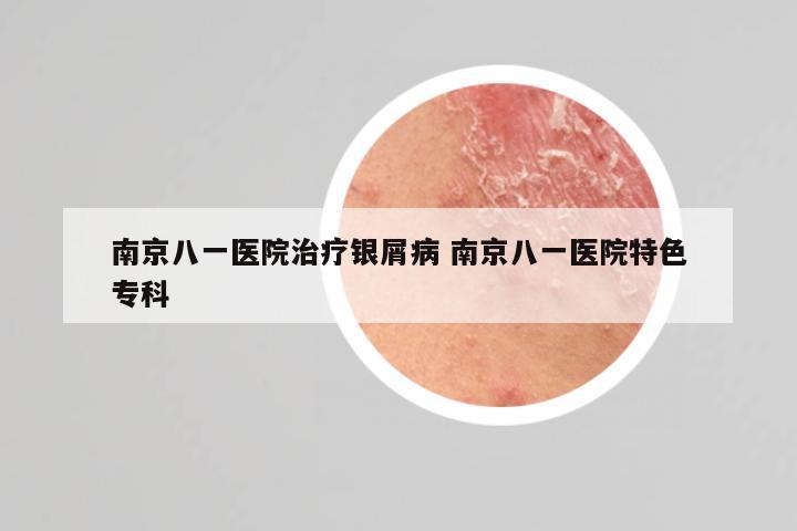 南京八一医院治疗银屑病 南京八一医院特色专科