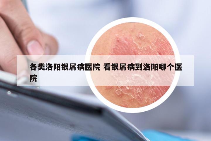 各类洛阳银屑病医院 看银屑病到洛阳哪个医院