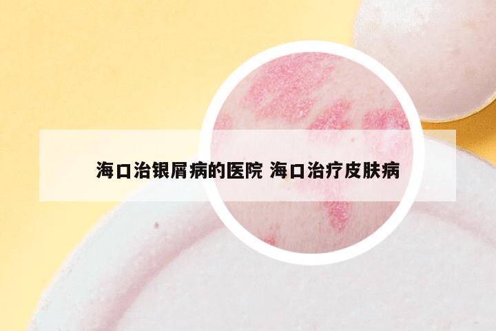 海口治银屑病的医院 海口治疗皮肤病