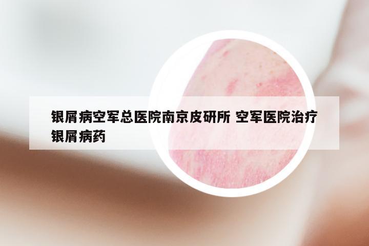 银屑病空军总医院南京皮研所 空军医院治疗银屑病药