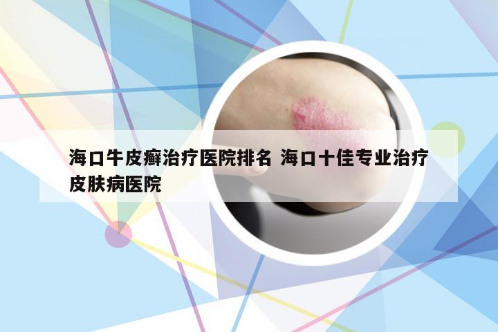 海口牛皮癣治疗医院排名 海口十佳专业治疗皮肤病医院