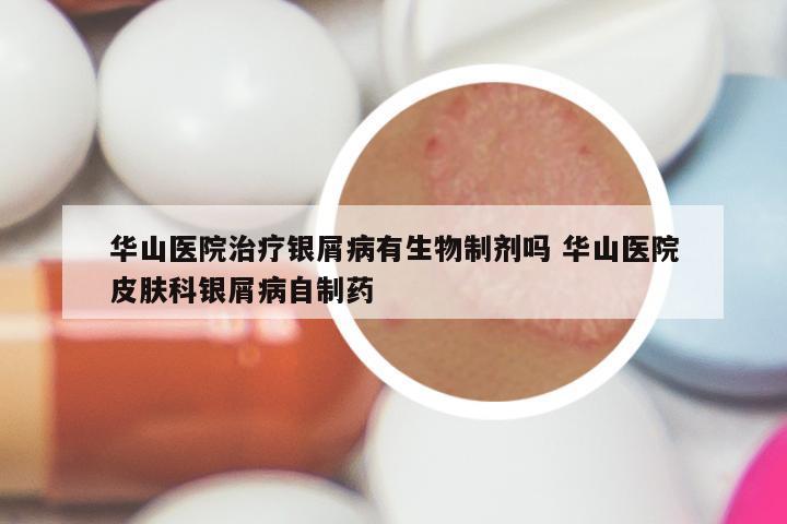 华山医院治疗银屑病有生物制剂吗 华山医院皮肤科银屑病自制药