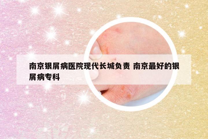 南京银屑病医院现代长城负责 南京最好的银屑病专科