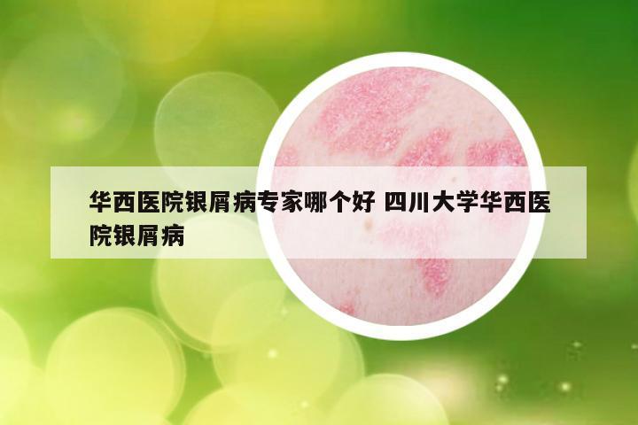 华西医院银屑病专家哪个好 四川大学华西医院银屑病
