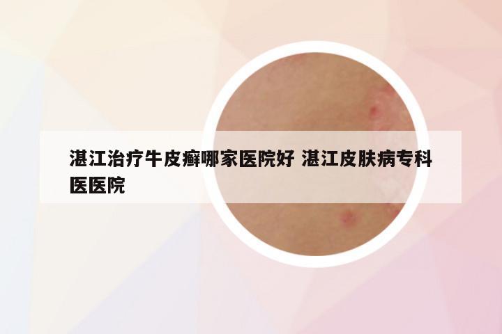 湛江治疗牛皮癣哪家医院好 湛江皮肤病专科医医院