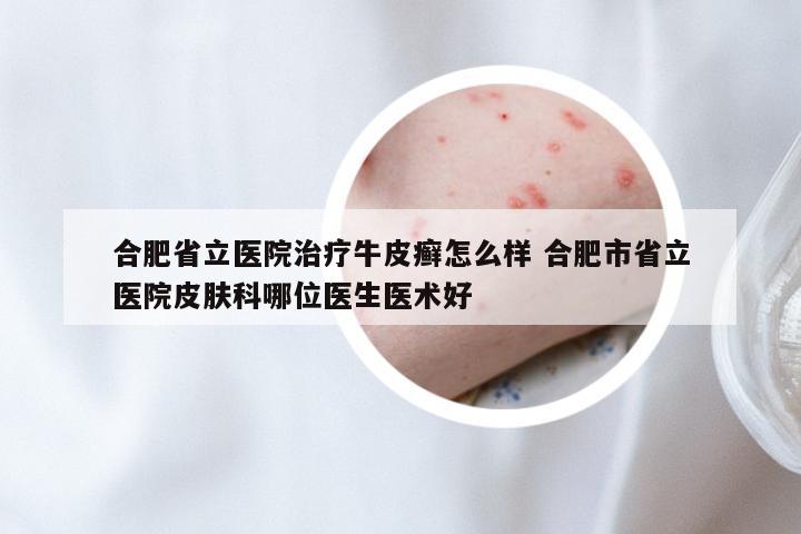 合肥省立医院治疗牛皮癣怎么样 合肥市省立医院皮肤科哪位医生医术好