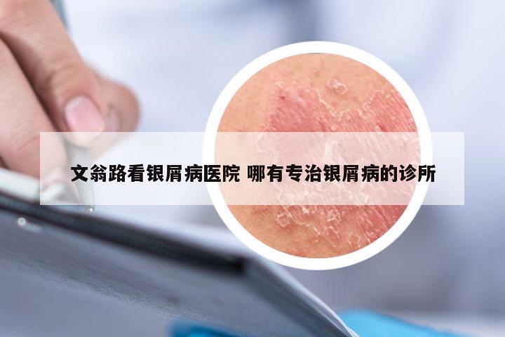 文翁路看银屑病医院 哪有专治银屑病的诊所