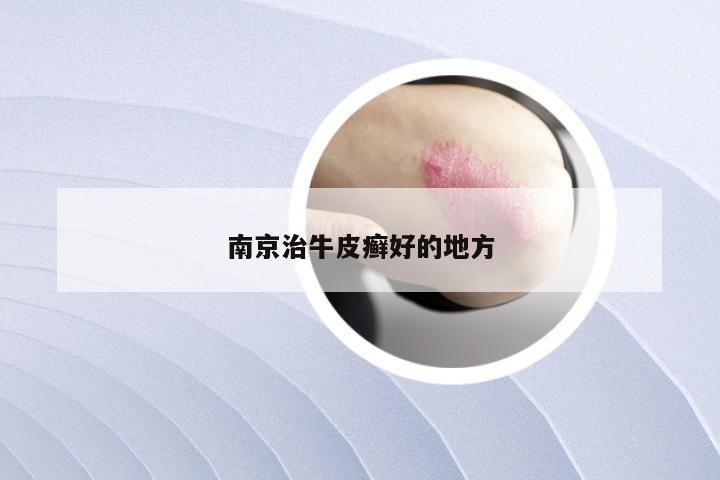 南京治牛皮癣好的地方