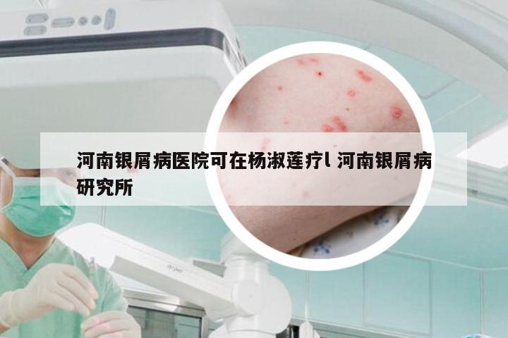 河南银屑病医院可在杨淑莲疗l 河南银屑病研究所