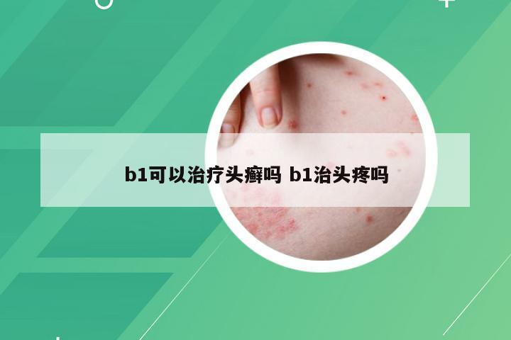 b1可以治疗头癣吗 b1治头疼吗