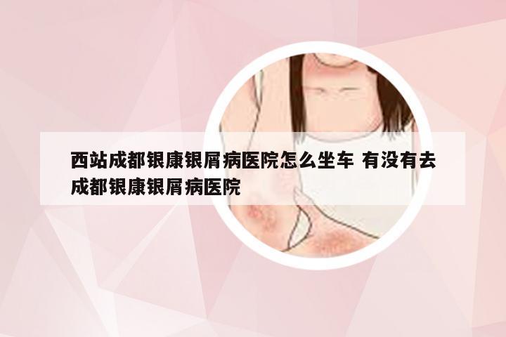 西站成都银康银屑病医院怎么坐车 有没有去成都银康银屑病医院