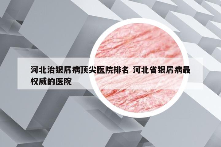 河北治银屑病顶尖医院排名 河北省银屑病最权威的医院
