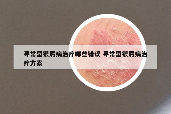 寻常型银屑病治疗哪些错误 寻常型银屑病治疗方案