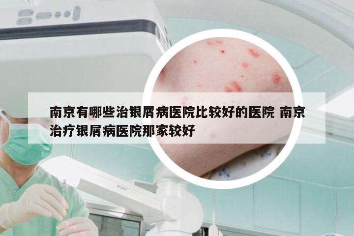 南京有哪些治银屑病医院比较好的医院 南京治疗银屑病医院那家较好