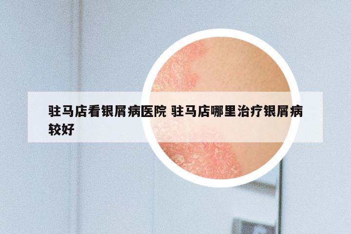 驻马店看银屑病医院 驻马店哪里治疗银屑病较好