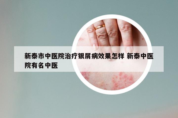 新泰市中医院治疗银屑病效果怎样 新泰中医院有名中医