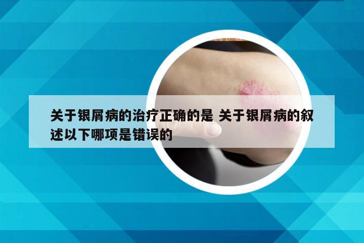 关于银屑病的治疗正确的是 关于银屑病的叙述以下哪项是错误的
