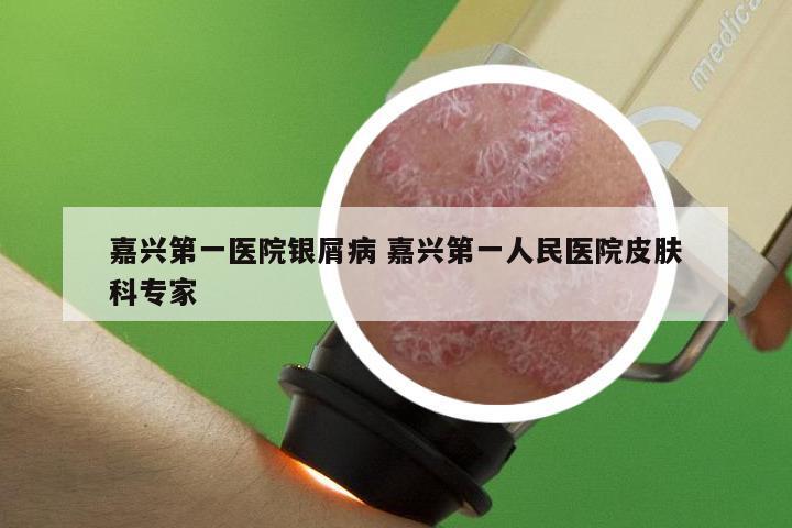 嘉兴第一医院银屑病 嘉兴第一人民医院皮肤科专家