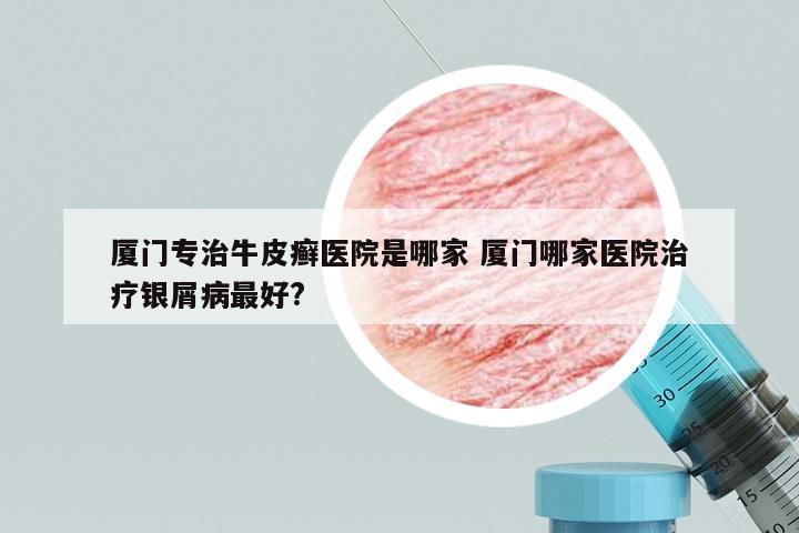 厦门专治牛皮癣医院是哪家 厦门哪家医院治疗银屑病最好?