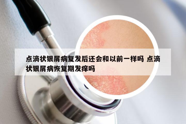 点滴状银屑病复发后还会和以前一样吗 点滴状银屑病恢复期发痒吗