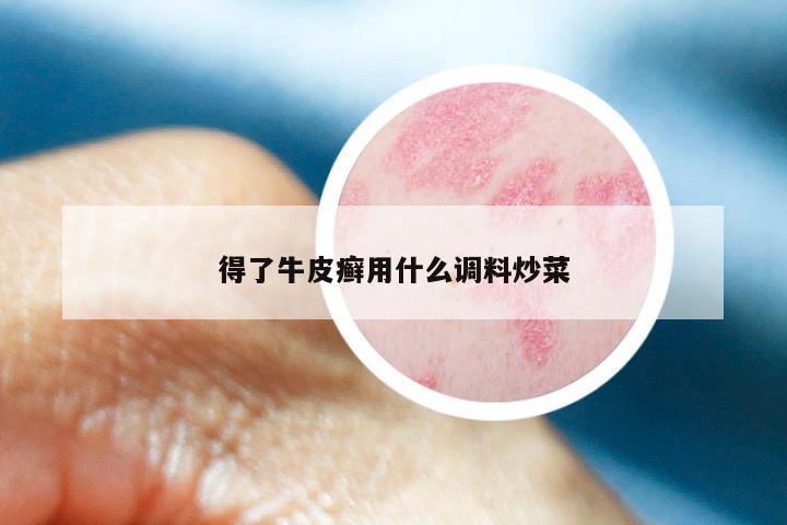 得了牛皮癣用什么调料炒菜