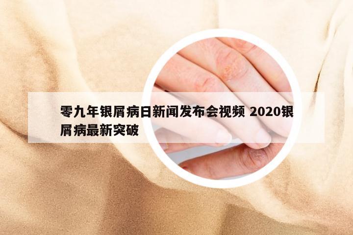 零九年银屑病日新闻发布会视频 2020银屑病最新突破