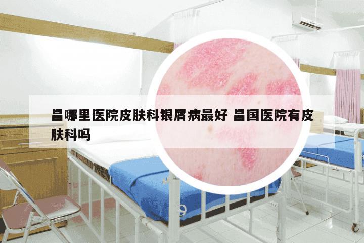 昌哪里医院皮肤科银屑病最好 昌国医院有皮肤科吗