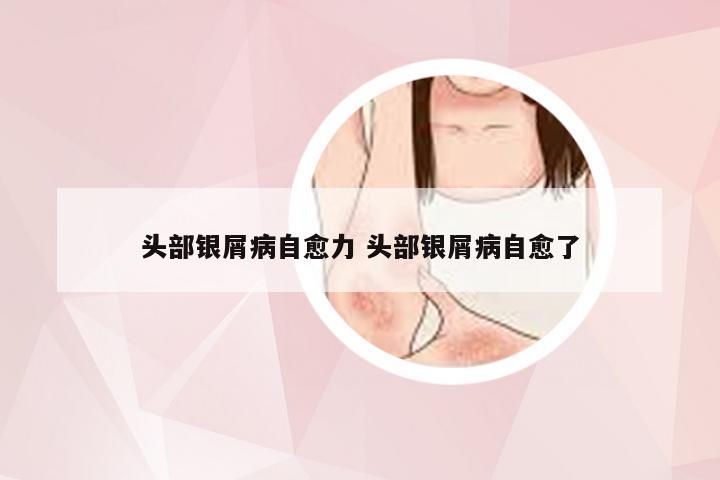 头部银屑病自愈力 头部银屑病自愈了