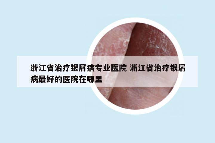 浙江省治疗银屑病专业医院 浙江省治疗银屑病最好的医院在哪里
