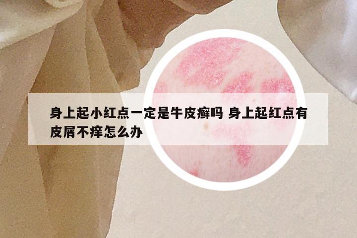 身上起小红点一定是牛皮癣吗 身上起红点有皮屑不痒怎么办