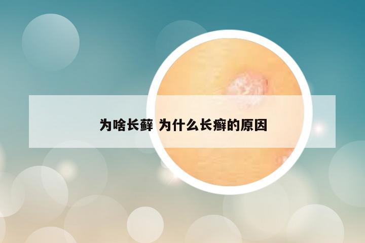 为啥长藓 为什么长癣的原因