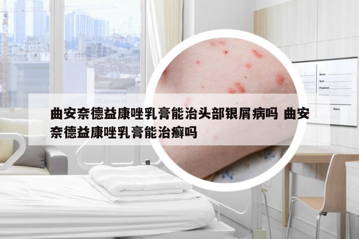 曲安奈德益康唑乳膏能治头部银屑病吗 曲安奈德益康唑乳膏能治癣吗
