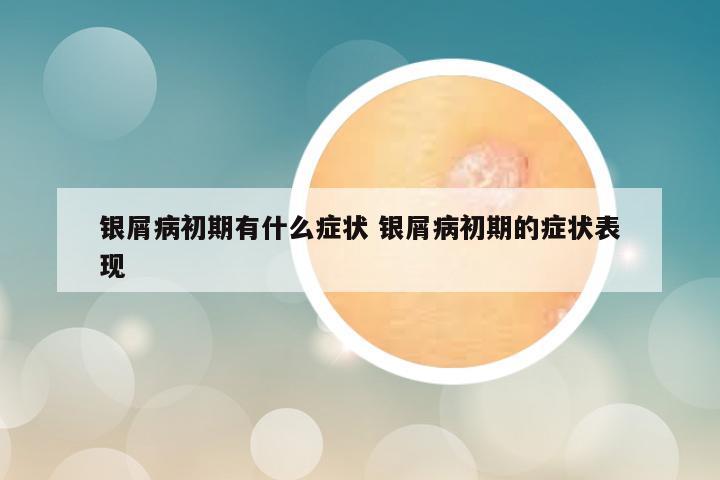 银屑病初期有什么症状 银屑病初期的症状表现
