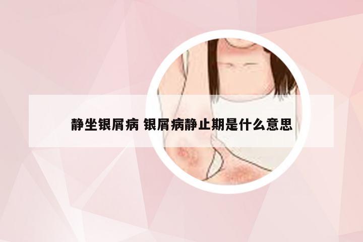 静坐银屑病 银屑病静止期是什么意思