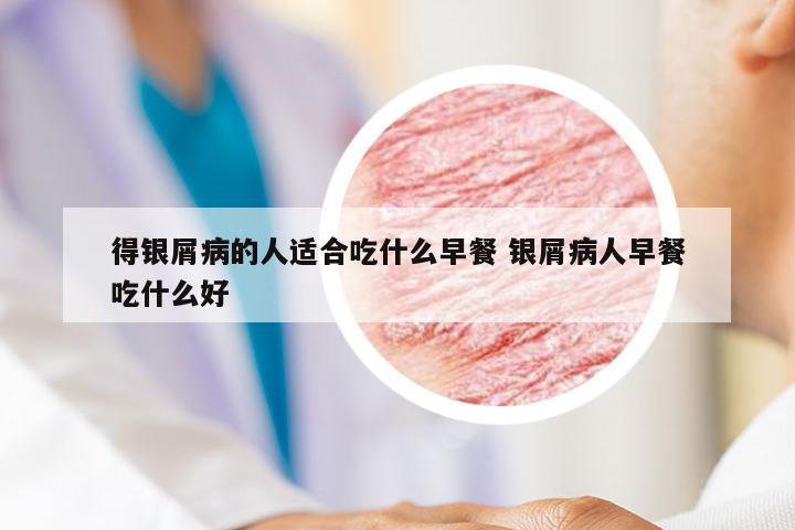 得银屑病的人适合吃什么早餐 银屑病人早餐吃什么好
