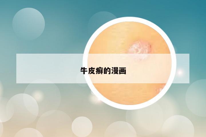 牛皮癣的漫画