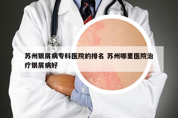 苏州银屑病专科医院的排名 苏州哪里医院治疗银屑病好
