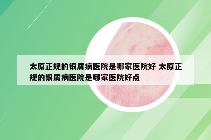 太原正规的银屑病医院是哪家医院好 太原正规的银屑病医院是哪家医院好点