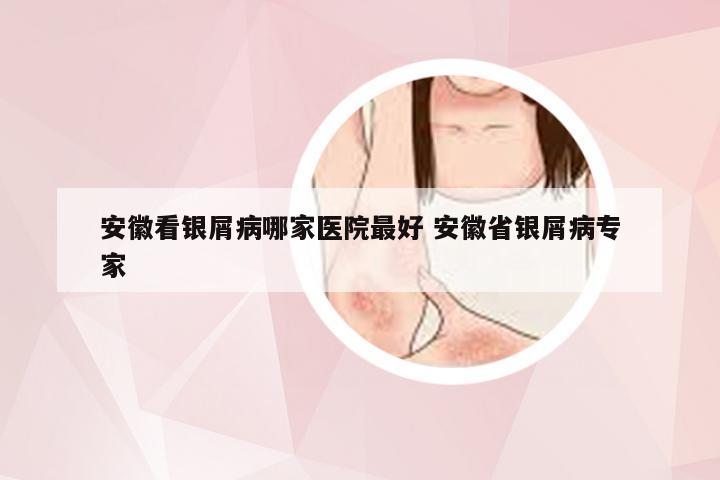 安徽看银屑病哪家医院最好 安徽省银屑病专家