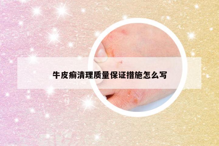 牛皮癣清理质量保证措施怎么写