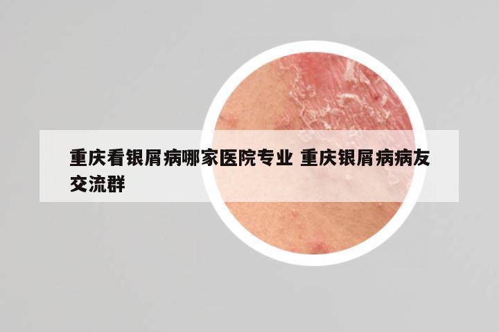 重庆看银屑病哪家医院专业 重庆银屑病病友交流群